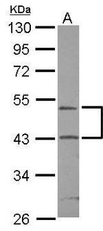 RUNDC3A Polyclonal Antibody