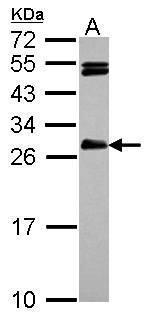 HAUS2 Polyclonal Antibody