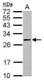 PRTFDC1 Polyclonal Antibody