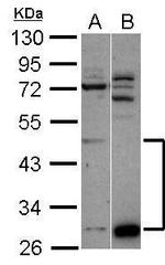 ZNF410 Polyclonal Antibody