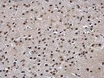 POLR2C Antibody in Immunohistochemistry (Paraffin) (IHC (P))
