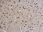 POLR2C Antibody in Immunohistochemistry (Paraffin) (IHC (P))