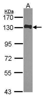 HAUS6 Antibody in Western Blot (WB)