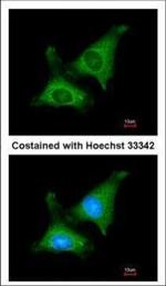 MTPAP Polyclonal Antibody