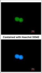 MRE11 Polyclonal Antibody