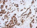 CCDC44 Antibody in Immunohistochemistry (Paraffin) (IHC (P))