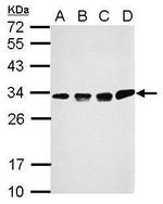 CCDC44 Antibody in Western Blot (WB)