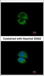 USE1 Polyclonal Antibody