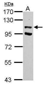 USP37 Polyclonal Antibody