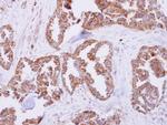 MRPL11 Polyclonal Antibody