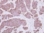 PLEKHF2 Antibody in Immunohistochemistry (Paraffin) (IHC (P))