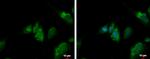 QTRT1 Polyclonal Antibody