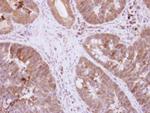 DIS3L2 Antibody in Immunohistochemistry (Paraffin) (IHC (P))