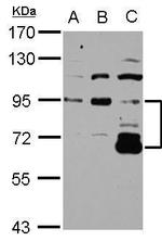 DIS3L2 Antibody in Western Blot (WB)