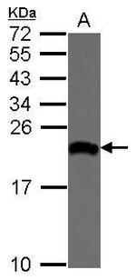 eIF1AX Polyclonal Antibody