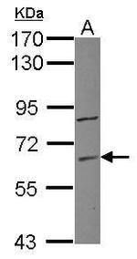 ZNF282 Polyclonal Antibody