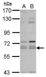 KLHL12 Polyclonal Antibody