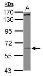 KIF19 Polyclonal Antibody