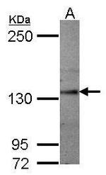 SEMA5A Polyclonal Antibody