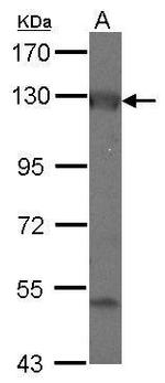 ADCY2 Polyclonal Antibody