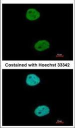 GTF3C4 Polyclonal Antibody