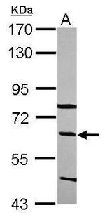 C8B Antibody in Western Blot (WB)