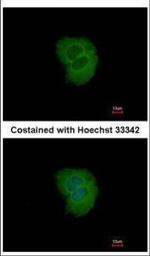 TRIM10 Polyclonal Antibody