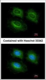 PDE10A Polyclonal Antibody