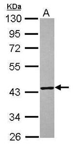 TXNL2 Polyclonal Antibody