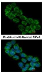 eIF3a Antibody in Immunocytochemistry (ICC/IF)