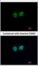 RCC2 Polyclonal Antibody