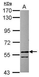 RCC2 Antibody in Western Blot (WB)