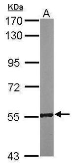 RCC2 Antibody in Western Blot (WB)