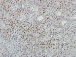MINA53 Polyclonal Antibody
