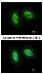 SASS6 Polyclonal Antibody