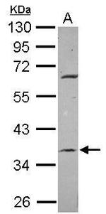 METTL2B Polyclonal Antibody
