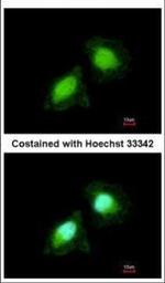 JTV-1 Polyclonal Antibody