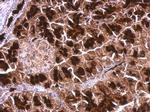 JTV-1 Antibody in Immunohistochemistry (Paraffin) (IHC (P))
