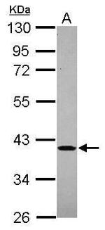 JTV-1 Antibody in Western Blot (WB)