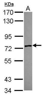 ZSWIM2 Antibody in Western Blot (WB)