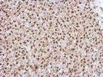 ZNF567 Antibody in Immunohistochemistry (Paraffin) (IHC (P))