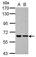 ZNF567 Antibody in Western Blot (WB)