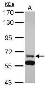 ZNF567 Antibody in Western Blot (WB)