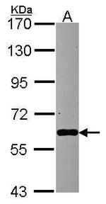 MTPAP Polyclonal Antibody