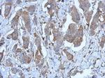 P2X2 Polyclonal Antibody