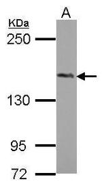 PHLPP2 Antibody in Western Blot (WB)