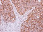YARS2 Polyclonal Antibody