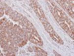 MRPS23 Antibody in Immunohistochemistry (Paraffin) (IHC (P))