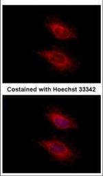 YARS2 Polyclonal Antibody