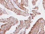 MRPS23 Antibody in Immunohistochemistry (Paraffin) (IHC (P))